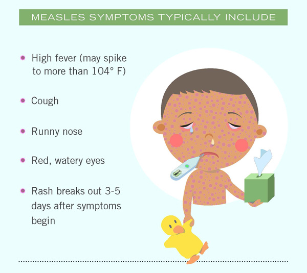 presentation of measles
